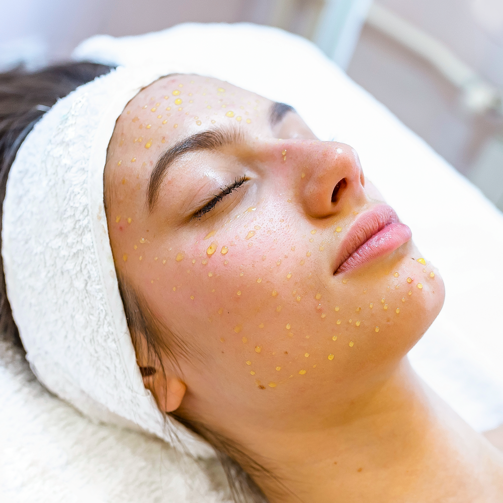 Cell Story Liquid Microneedling