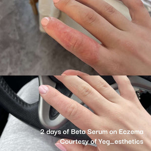 Neogenesis Beta - Glucan Serum - FACE by Gabrielle MancinoKin Aesthetics